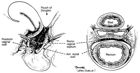 vulva pics|Category : Human surface anatomy of vulva